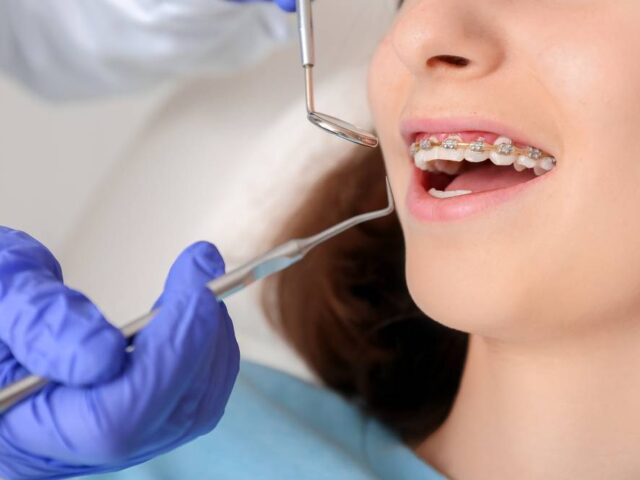 Tips To Become A Successful Orthodontist In Dubai